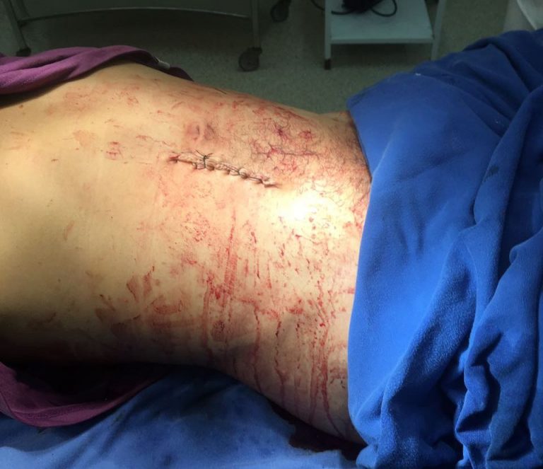 TARAUACÁ:  EM BEBEDEIRA ESPOSA MATA O MARIDO NO BAIRRO DA COPACABANA