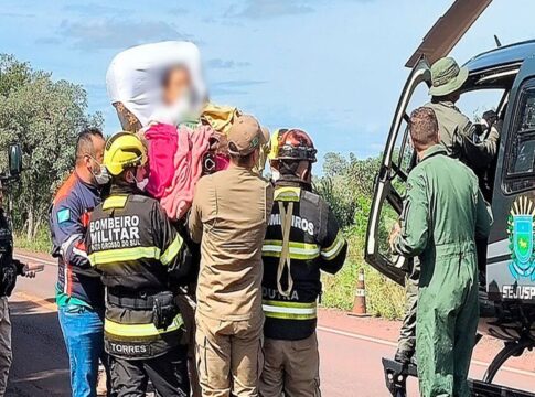 menina-de-6-anos-tem-perna-amputada-apos-acidente-com-onibus