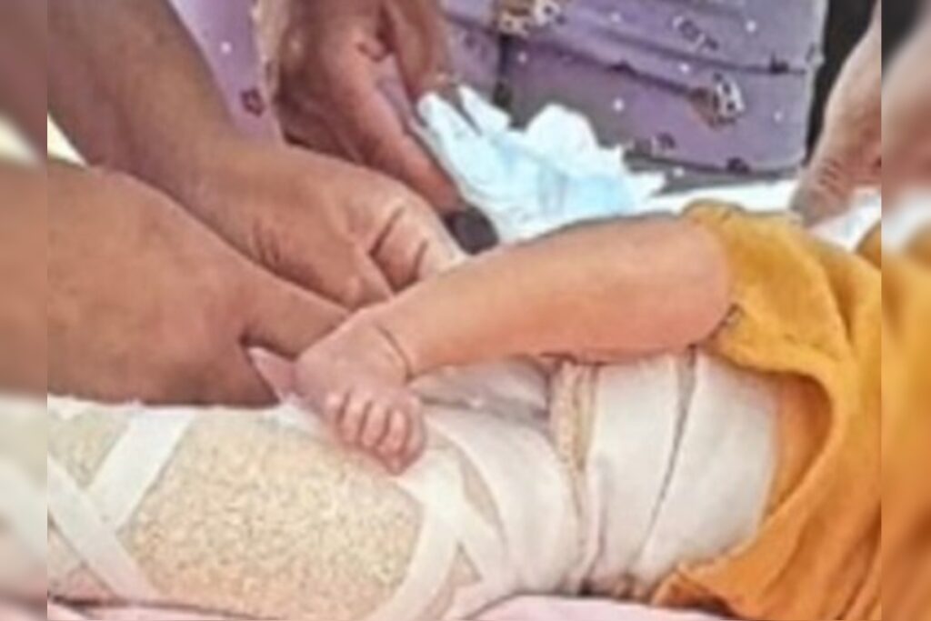 policia-apura-se-bebe-de-9-dias-fraturou-femur-em-teste-do-pezinho