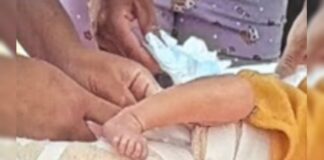 policia-apura-se-bebe-de-9-dias-fraturou-femur-em-teste-do-pezinho