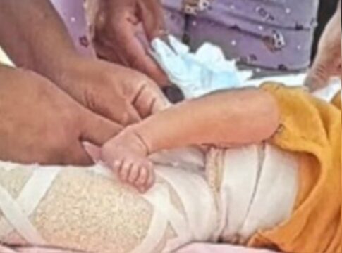 policia-apura-se-bebe-de-9-dias-fraturou-femur-em-teste-do-pezinho