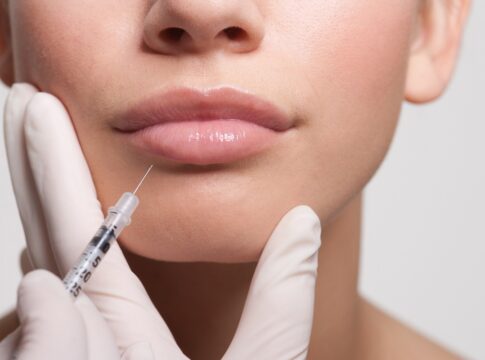 fez-botox?-veja-o-que-comer-para-manter-o-efeito-por-mais-tempo