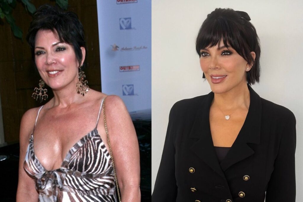 kris-jenner-antes-e-depois:-veja-imagens-dos-ultimos-25-anos