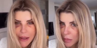iris-stefanelli-causa-comocao-ao-surgir-com-os-olhos-roxos:-“bateram?”
