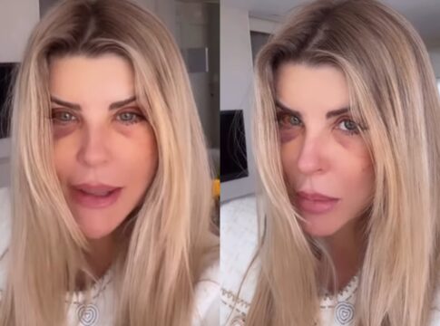 iris-stefanelli-causa-comocao-ao-surgir-com-os-olhos-roxos:-“bateram?”