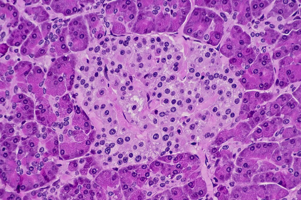 estresse-metabolico-pode-aumentar-a-producao-de-insulina-no-sangue