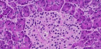 estresse-metabolico-pode-aumentar-a-producao-de-insulina-no-sangue