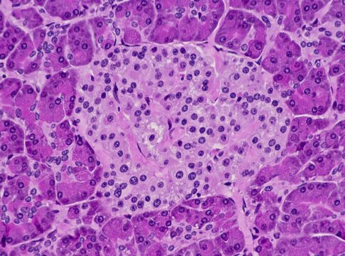 estresse-metabolico-pode-aumentar-a-producao-de-insulina-no-sangue