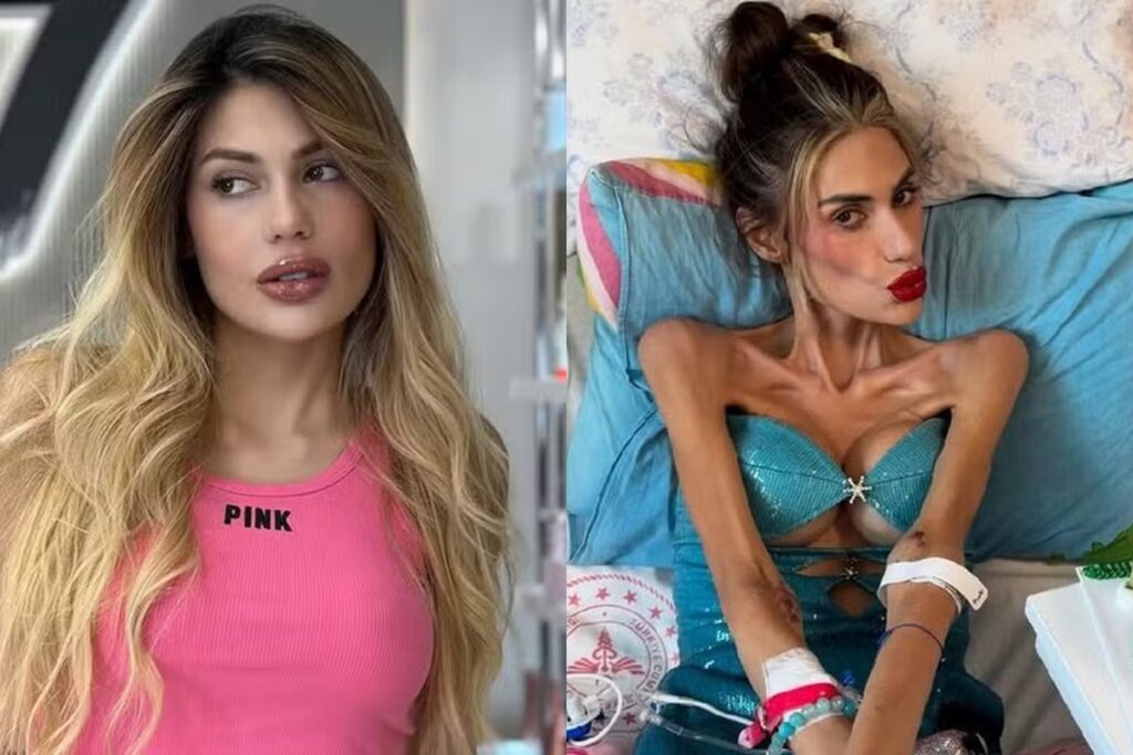 morre-influencer-de-30-anos-que-pesava-22-kg:-“arruinaram-a-vida-dela”