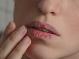 labios-protegidos-no-frio:-4-hidratantes-bons-e-baratos-ate-r$-30