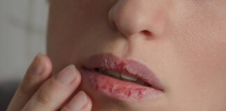 labios-protegidos-no-frio:-4-hidratantes-bons-e-baratos-ate-r$-30