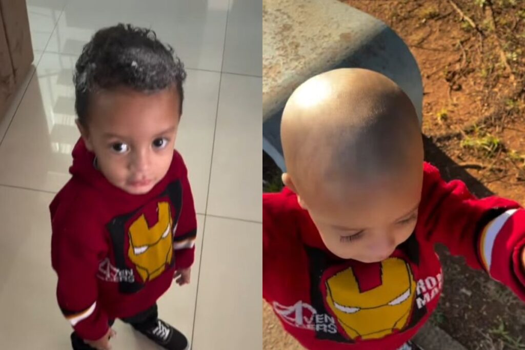 video:-crianca-usa-creme-depilatorio-na-cabeca-e-perde-o-cabelo