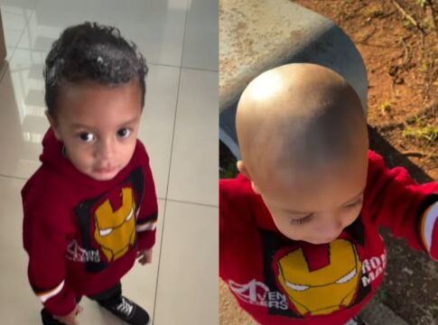 video:-crianca-usa-creme-depilatorio-na-cabeca-e-perde-o-cabelo