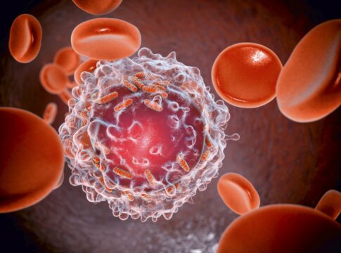 5-mitos-e-verdades-sobre-a-leucemia