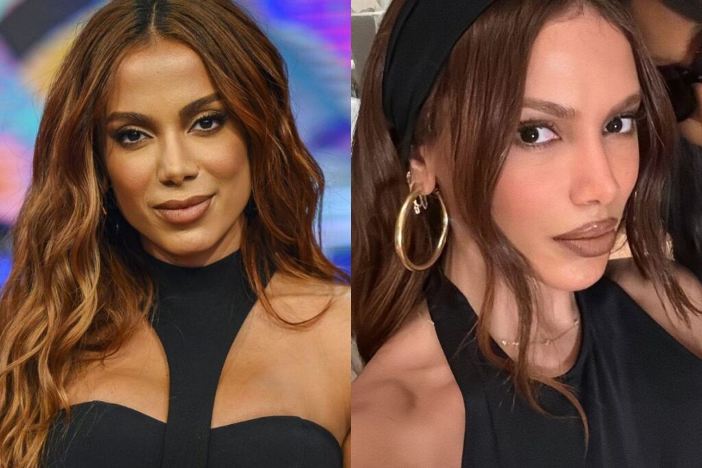 antes-e-depois:-veja-novo-rosto-de-anitta-em-1a-aparicao-apos-infeccao