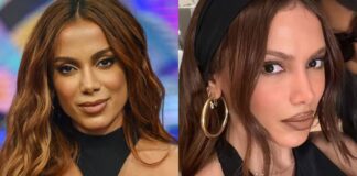 antes-e-depois:-veja-novo-rosto-de-anitta-em-1a-aparicao-apos-infeccao