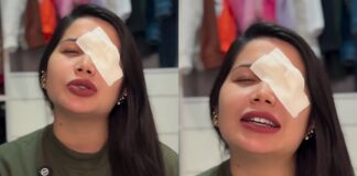 influencer-tem-hemorragia-ocular-apos-usar-lentes-vencidas-em-trend