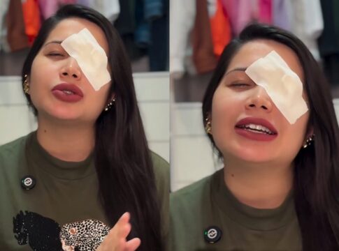 influencer-tem-hemorragia-ocular-apos-usar-lentes-vencidas-em-trend