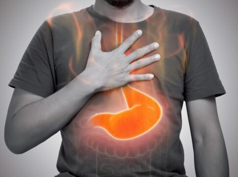 6-habitos-que-pioram-o-refluxo-e-como-evita-los,-segundo-nutricionista