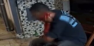 sangue-escorre-por-pescoco-de-homem-atacado-em-bar-no-df.-video