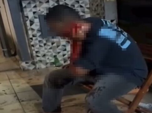 sangue-escorre-por-pescoco-de-homem-atacado-em-bar-no-df.-video