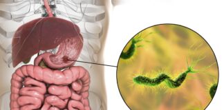 medico-aponta-cha-anti-inflamatorio-que-ajuda-a-combater-a-h.-pylori