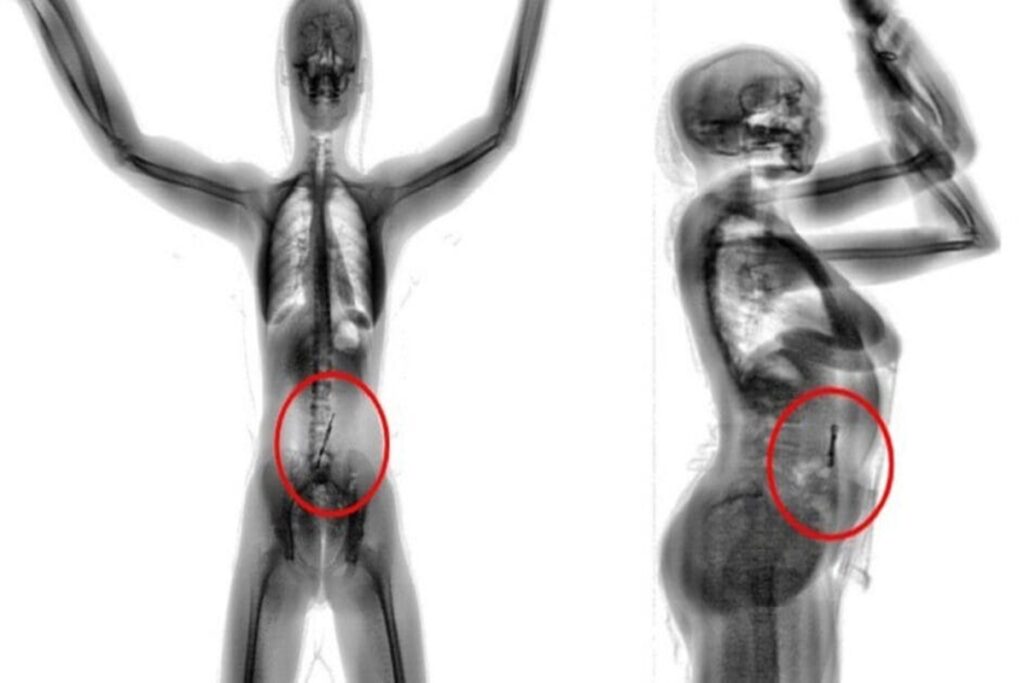 mulher-tenta-entrar-em-presidio-com-droga,-mas-e-flagrada-por-scanner