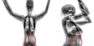 mulher-tenta-entrar-em-presidio-com-droga,-mas-e-flagrada-por-scanner