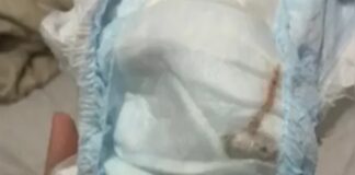 rio:-“rato”-encontrado-em-fralda-de-bebe-era-um-pedaco-de-plastico