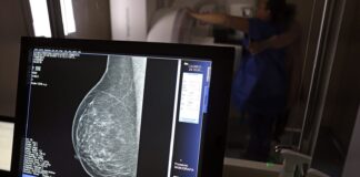 cancer-de-mama:-uma em-cada-tres pacientes tem-menos-de-50-anos