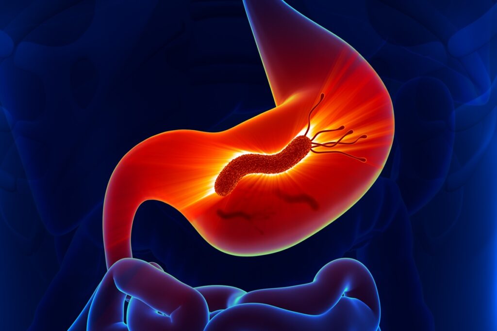 medico-cita-qual-suplemento-atua-contra-a-h.-pylori-e-como-consumi-lo