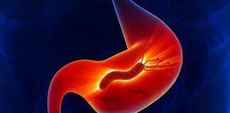 medico-cita-qual-suplemento-atua-contra-a-h.-pylori-e-como-consumi-lo