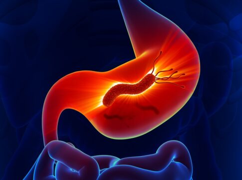 medico-cita-qual-suplemento-atua-contra-a-h.-pylori-e-como-consumi-lo