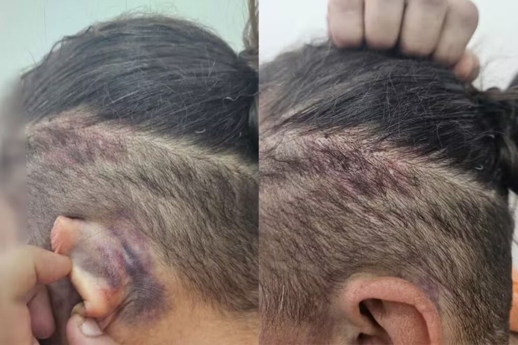 punicao-por-engano:-trio-que-sequestrou-e-torturou-mulher-e-preso