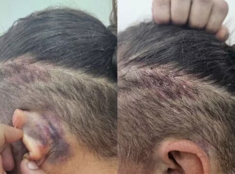 punicao-por-engano:-trio-que-sequestrou-e-torturou-mulher-e-preso