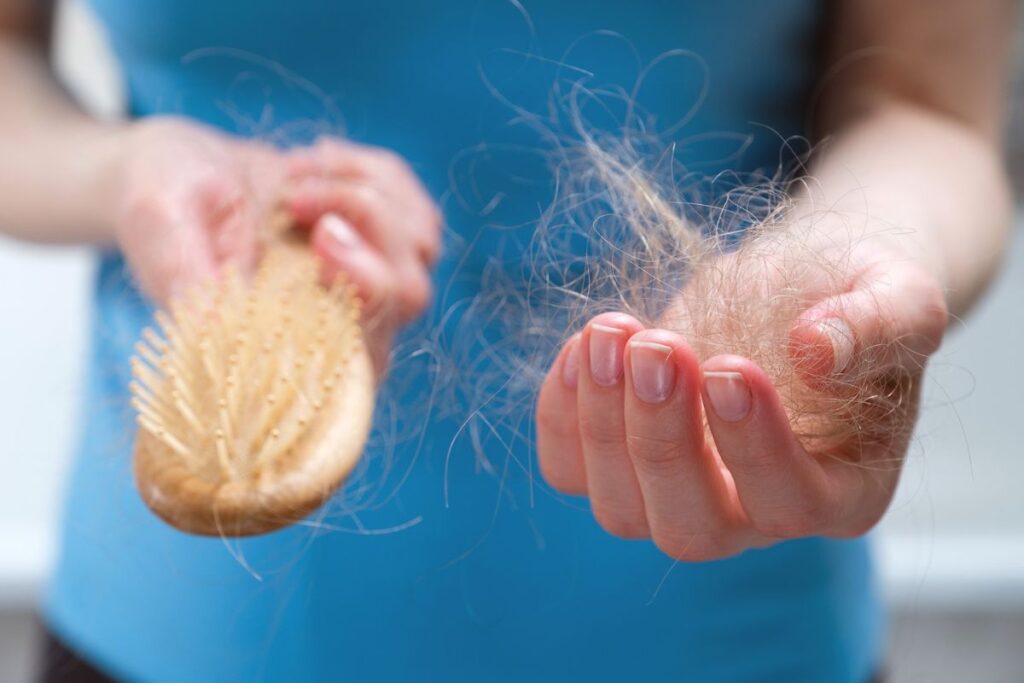 queda-de-cabelo:-dermatologista-revela-primeiros-sinais-de-calvicie