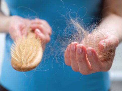 queda-de-cabelo:-dermatologista-revela-primeiros-sinais-de-calvicie