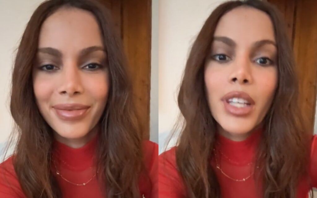 anitta-se-pronuncia-sobre-ter-ficado-“desfigurada”-apos-procedimento