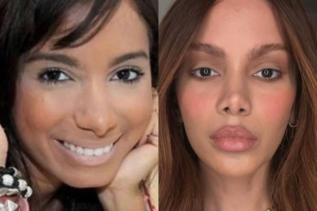 anitta-antes-e-depois:-confira-o-quanto-a-cantora-mudou-desde-2013