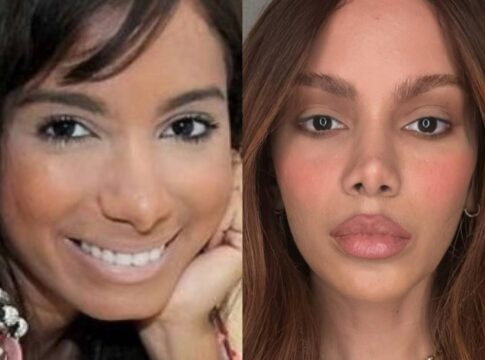 anitta-antes-e-depois:-confira-o-quanto-a-cantora-mudou-desde-2013
