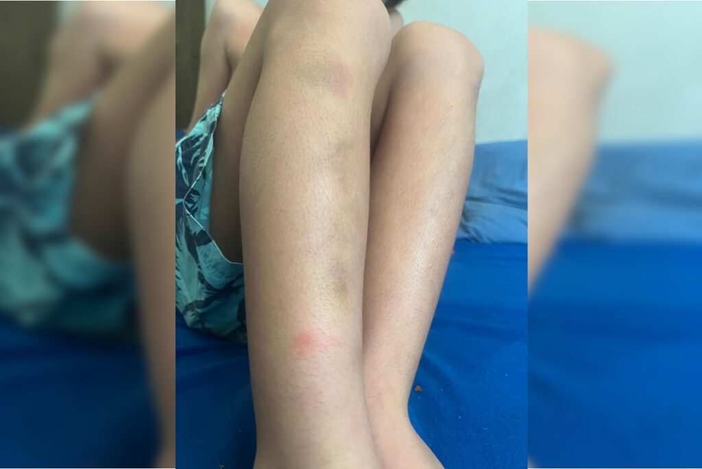 filho-de-publicitario-preso-e-agredido-por-agentes-ficou-com-hematomas