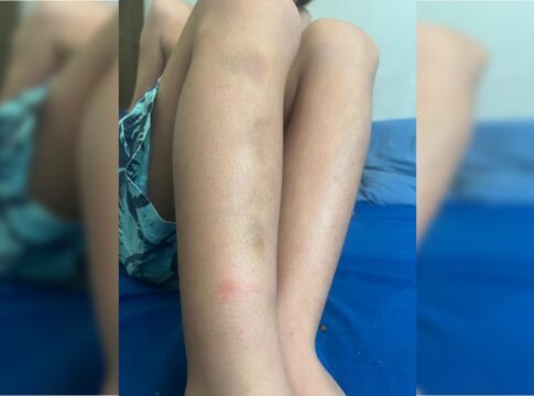 filho-de-publicitario-preso-e-agredido-por-agentes-ficou-com-hematomas