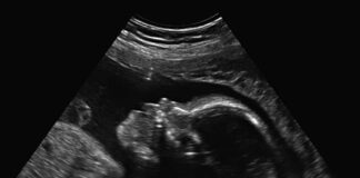 df:-adolescente-asfixia-e-joga-bebe-prematuro-no-lixo-ao-forcar-aborto