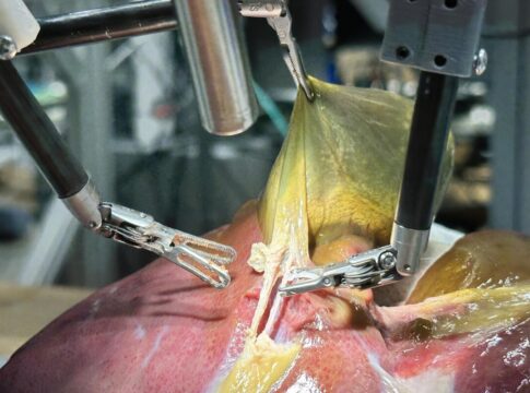 robo-faz-cirurgia-orientado-por-ia-e-sem-nenhuma-assistencia-humana