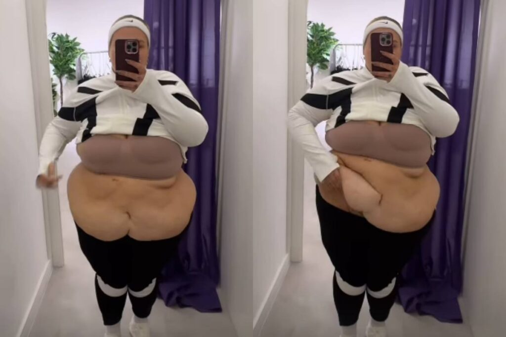 thais-carla-reclama-do-excesso-de-pele-apos-perder-mais-de-50-kg