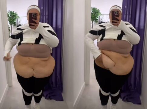 thais-carla-reclama-do-excesso-de-pele-apos-perder-mais-de-50-kg