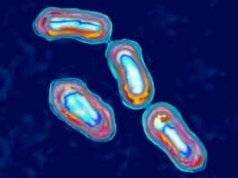 paciente-nos-eua-morre-com-bacteria-da-“grande-peste”-da-idade-media