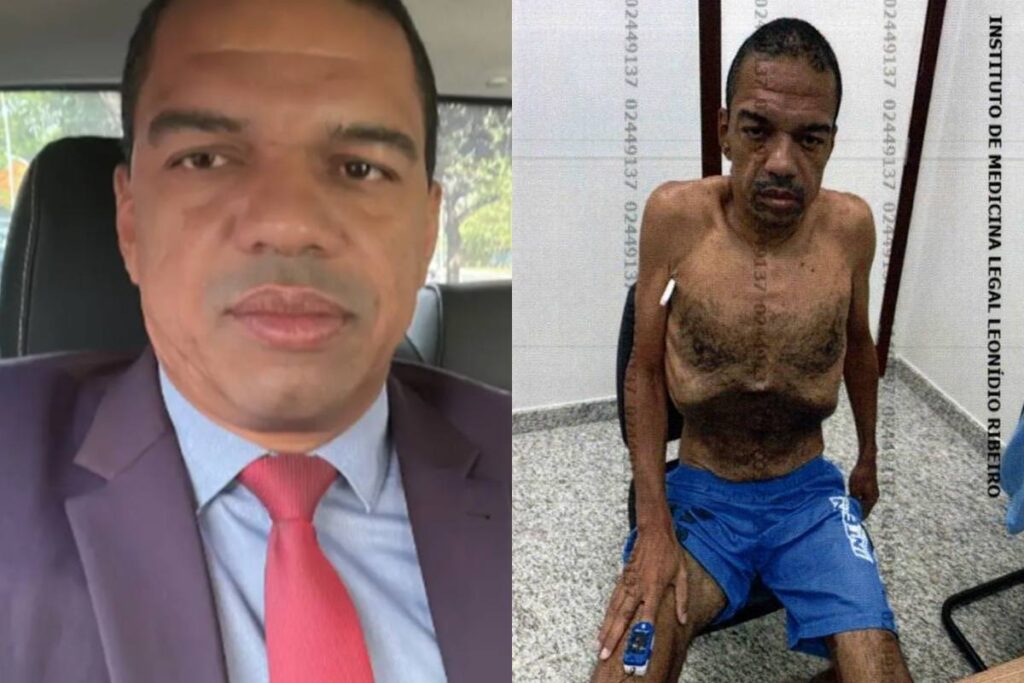 zanin-concede-prisao-domiciliar-a-investigado-por-venda-de-sentencas-que-quase-morreu-na-papuda