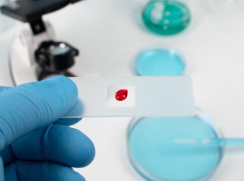 estudo-da-usp-identifica-proteinas-chave-para-tratamento-contra-cancer