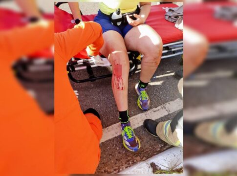video:-medica-teve-sangramento-abundante-apos-ser-atacada-por-10-caes